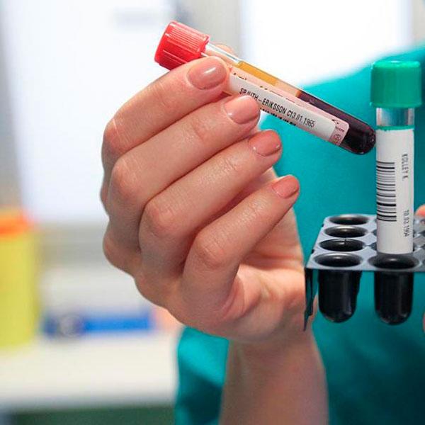 Акция! Тест на антитела к COVID-19 за 1 рубль